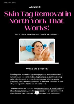 Skin Tag Removal in North York That Works!