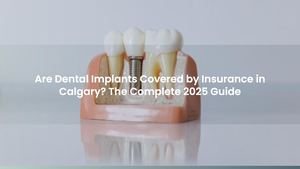 Are Dental Implants Covered by Insurance in Calgary? The Complete 2025 Guide