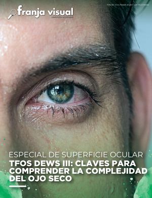 Especial SO - DEWS III: CLAVES PARA COMPRENDER LA  COMPLEJIDAD DEL OJO SECO