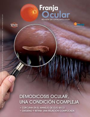 Franja Ocular 130