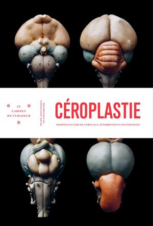 Céroplastie. Modèles en cire de cerveaux, d’embryons et de parasites
