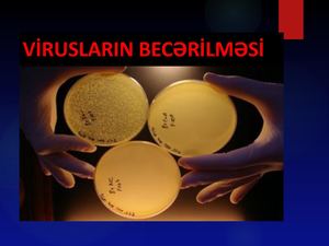 Qurbanlı Arzu 174