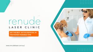 Renude Laser - Tattoo Removal Sydney