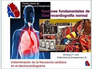 Determinación de la Frecuencia cardiaca en EKG