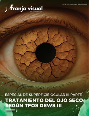 Superficie Ocular III