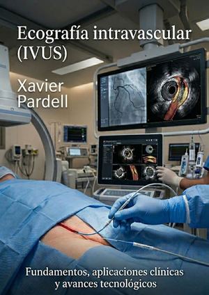 Ecografía Intravascular
