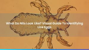 What Do Nits Look Like? Visual Guide To Identifying Lice Eggs