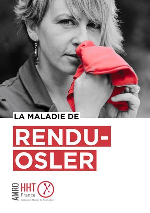 La Maladie De Rendu Osler Livret Digital