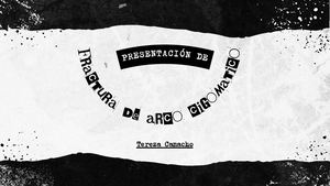 Fractura De Arco Cigomatico