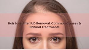 Hair Loss After IUD Removal: Common Causes & Natural Treatments