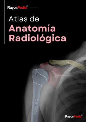 Anatomía Radiológica Rayospedia