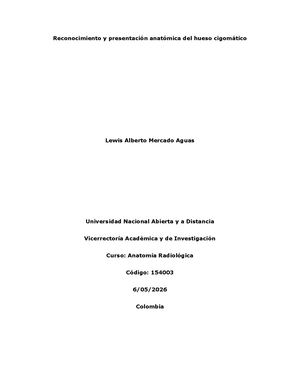 Hueso Cigomático