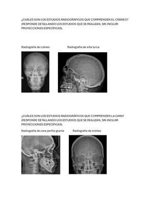 Estructuras De Craneo Y Cara