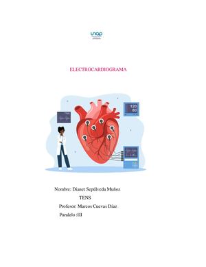 Electrocardiograma