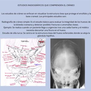 ANATOMIA DEL CRANEO Y CARA