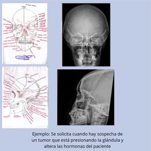 Anatomia De Craneo Y Cara