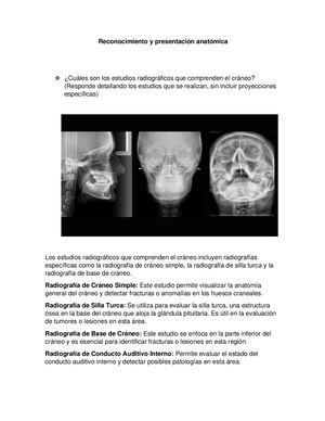 Estructuras Anatomica De Craneo Y Cara