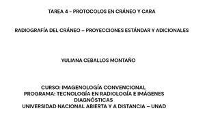 Tarea 4 Protocolos En Cráneo Y Cara