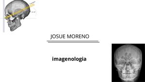 Estudios Radiográficos Del Hombro, Clavícula Y Articulación Acromioclavicul 20260516 092438 0000 Compressed