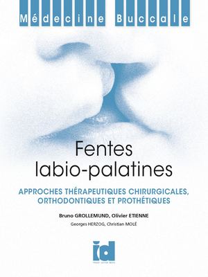 Fentes Labiales - Preview