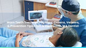 Worn Teeth Treatment Options: Crowns, Veneers, & Prevention Tips From A Vancouver, WA Dentist