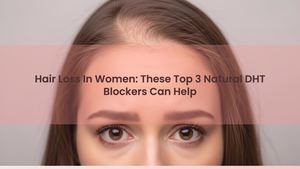 Hair Loss In Women: These Top 3 Natural DHT Blockers Can Help