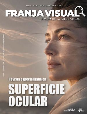 ••Franja Visual especia Superficie Ocular