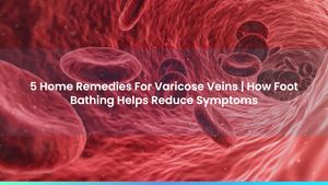 5 Home Remedies For Varicose Veins | How Foot Bathing Helps Reduce Symptoms