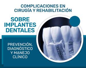 Ppt Residentes De Implantologia Oral Y Reconstructiva
