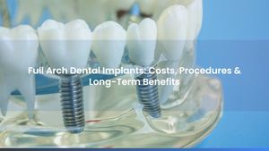 Full Arch Dental Implants: Costs, Procedures & Long-Term Benefits