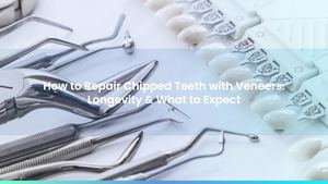 How to Repair Chipped Teeth with Veneers: Longevity & What to Expect