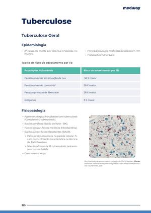Tuberculose Eufi Ybs