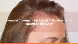Stem Cell Treatment For Receding Hairlines: What Patients Should Know