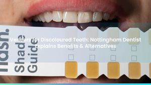 Veneers for Discoloured Teeth: Nottingham Dentist Explains Benefits & Alternatives