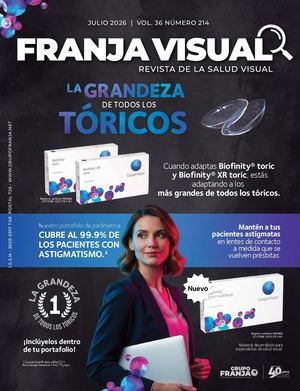 FRANJA VISUAL 214