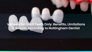 Veneers for Front Teeth Only: Benefits, Limitations & Results According to Nottingham Dentist