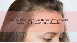 Hairline Receding? Hair Thinning? Try The #1 Natural Solution For Hair Growth
