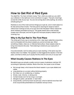 How To Get Rid Of Red Eyes