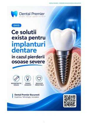Ce solutii exista pentru implanturi dentare in cazul pierderii osoase severe