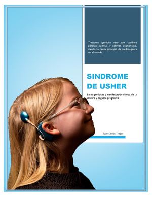 Sindrome De Usher - Juan Trejos