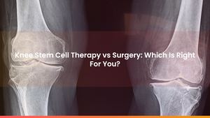 Knee Stem Cell Therapy vs Surgery: Which Is Right For You?