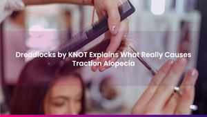 Dreadlocks by KNOT Explains What Really Causes Traction Alopecia